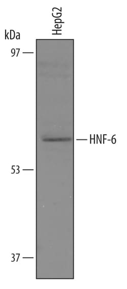 Human HNF-6/ONECUT1 Antibody, R D Systems 25 &mu;g | Buy Online | R&D Systems | Fisher Scientific