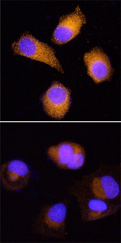 Human HOIP/RNF31 Antibody, R D Systems 100ug; Unlabeled:Antibodies, Monoclonal