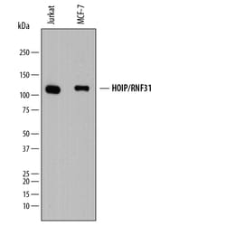 Human HOIP/RNF31 Antibody, R D Systems 100ug; Unlabeled:Antibodies, Monoclonal
