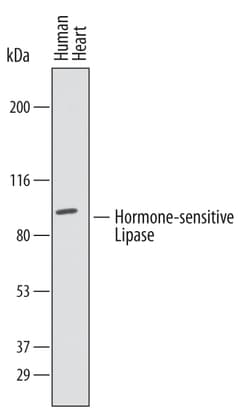 Human Hormone-sensitive Lipase/HSL Antibody, R D Systems 25&mu;g; Unlabeled:Antibodies,