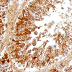 Human Hormone-sensitive Lipase/HSL Antibody, R D Systems 100ug; Unlabeled:Antibodies,