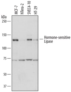 Human Hormone-sensitive Lipase/HSL Antibody, R D Systems 100ug; Unlabeled:Antibodies,