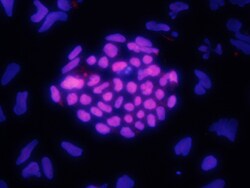 Human HOXA1 Antibody, R D Systems 100&mu;g; Unlabeled:Antibodies, Polyclonal