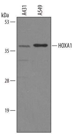 Human HOXA1 Antibody, R D Systems 100&mu;g; Unlabeled:Antibodies, Polyclonal