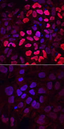 Human HOXB1 Antibody, R D Systems 100&mu;g; Unlabeled:Antibodies, Polyclonal