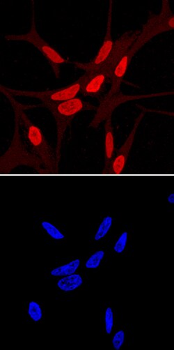 Human HOXB13 Antibody, R D Systems 100&mu;g; Unlabeled:Antibodies, Polyclonal