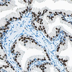 Human HOXB13 Antibody, R D Systems 100&mu;g; Unlabeled:Antibodies, Polyclonal