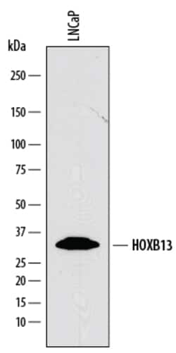Human HOXB13 Antibody, R D Systems 100&mu;g; Unlabeled:Antibodies, Polyclonal