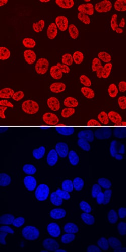 Human HOXB7 Antibody, R D Systems 100ug; Unlabeled:Antibodies, Monoclonal
