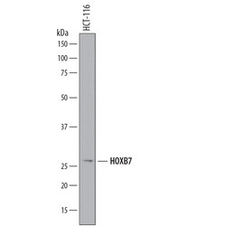 Human HOXB7 Antibody, R D Systems 25&mu;g; Unlabeled:Antibodies, Monoclonal