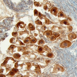 Mouse Heparan Sulfate 6-O-Sulfotransferase 3/HS6ST3 Antibody, R D Systems