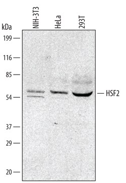 Human/Mouse HSF2 Antibody, R D Systems 100&mu;g; Unlabeled:Antibodies,