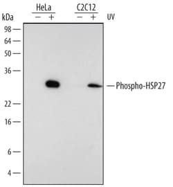 Human/Mouse/Rat Phospho-HSP27 (S78/S82) Antibody, R D Systems 50&mu;g;