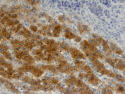 Human/Mouse/Rat HSP70/HSPA1A Antibody, R&D Systems™