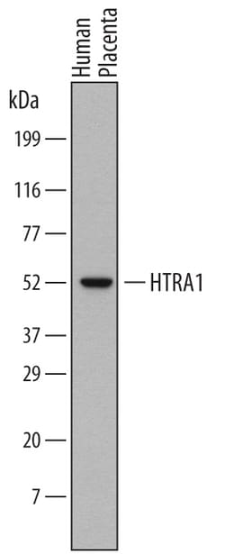 Human HTRA1/PRSS11 Antibody, R D Systems 25&mu;g; Unlabeled:Antibodies,