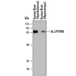 Human IA-2/PTPRN Antibody, R D Systems 100ug; Unlabeled:Antibodies, Monoclonal