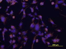 Human ICAM-1/CD54 Antibody, R D Systems:Antibodies:Primary Antibodies