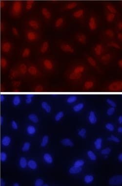 Human ID2 Antibody, R D Systems 100&mu;g; Unlabeled:Antibodies, Polyclonal