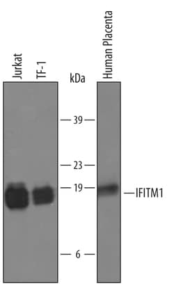 Human IFITM1 Antibody, R D Systems 25&mu;g; Unlabeled:Antibodies, Polyclonal