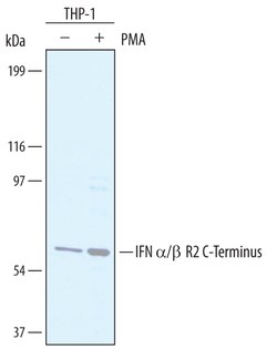 Human IFN-alpha/beta R2 C-Terminus Antibody, R D Systems 100&mu;g; Unlabeled:Antibodies,