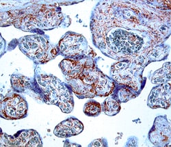 Human IGFBP-3 Antibody, R D Systems:Antibodies:Primary Antibodies
