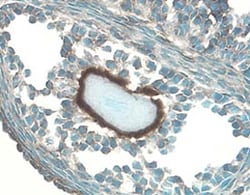Mouse IGFBP-5 Antibody, R D Systems 100&mu;g; Unlabeled:Antibodies, Polyclonal