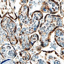 Human IGFBP-5 Antibody, R D Systems 100&mu;g; Unlabeled:Antibodies, Polyclonal