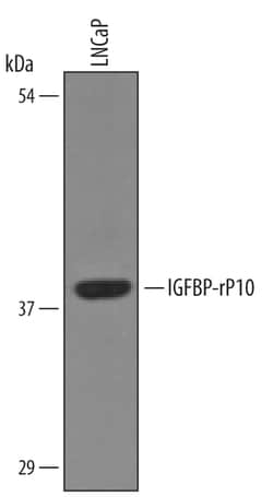 Human IGFBP-rP10 Antibody, R D Systems 25&mu;g; Unlabeled:Antibodies, Polyclonal