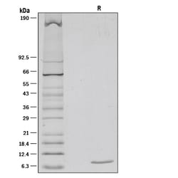 R&D Systems™ Recombinant Mouse IGF-I/IGF-1 Protein