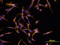 Human IGF-I/IGF-1 Antibody, R D Systems 25&mu;g; Unlabeled:Antibodies,