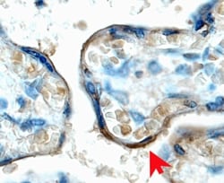 Human/Mouse IGF-I R/IGF1R Antibody, R D Systems 25&mu;g; Unlabeled:Antibodies,