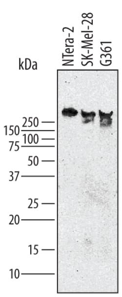 Human/Mouse IGF-I R/IGF1R Antibody, R D Systems:Antibodies:Primary Antibodies