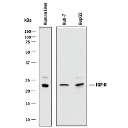 Human IGF-II/IGF2 Antibody, R D Systems 25&mu;g; Unlabeled:Antibodies,