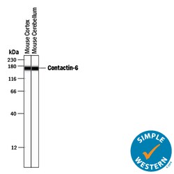 Sheep IgG Horseradish Peroxidase-conjugated Antibody, R D Systems 1 mL;