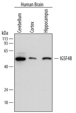 Human IGSF4B/SynCAM3 Antibody, R D Systems 100 &mu;g | Buy Online | R&D Systems | Fisher Scientific