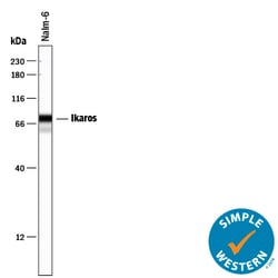 Human Ikaros Antibody, R D Systems 25&mu;g; Unlabeled:Antibodies, Polyclonal
