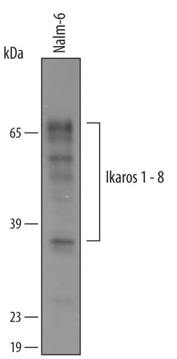 Human Ikaros Antibody, R D Systems 25&mu;g; Unlabeled:Antibodies, Polyclonal