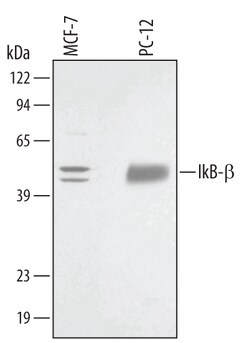 Human/Rat IkB-beta Antibody, R D Systems 100ug; Unlabeled:Antibodies, Monoclonal
