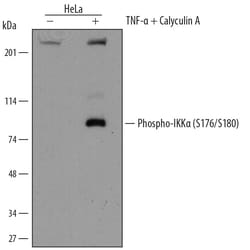 Human Phospho-IKK alpha (S176/S180) Antibody, R D Systems 25&mu;g; Unlabeled:Antibodies,