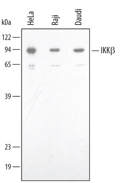 Human IKK beta Antibody, R D Systems 25&mu;g; Unlabeled:Antibodies, Polyclonal