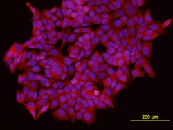 Human/Mouse/Rat IKK epsilon Antibody, R D Systems 25&mu;g; Unlabeled:Antibodies,