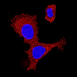 Human/Mouse/Rat IKK gamma Antibody, R D Systems 100&mu;g; Unlabeled:Antibodies,