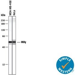 Human/Mouse/Rat IKK gamma Antibody, R D Systems 100&mu;g; Unlabeled:Antibodies,