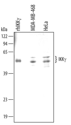 Human/Mouse/Rat IKK gamma Antibody, R D Systems 100&mu;g; Unlabeled:Antibodies,