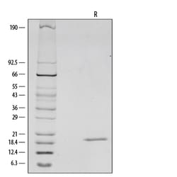 R D Systems Recombinant Mouse IL-1 beta/IL-1F2 Protein 25 &mu;g | Buy Online | R&amp;D Systems&trade; | Fisher Scientific