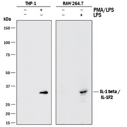 Human IL-1 beta/IL-1F2 Antibody, R D Systems 1 mg | Buy Online | R&D Systems | Fisher Scientific