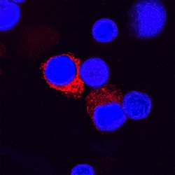 Human IL-1 beta/IL-1F2 Antibody, R D Systems 1 mg | Buy Online | R&D Systems | Fisher Scientific