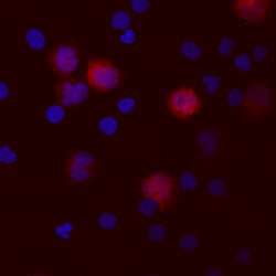 Human IL-1 beta/IL-1F2 Antibody, R D Systems 25&mu;g; Unlabeled:Antibodies,