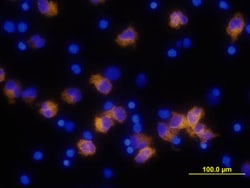 Human IL-1 beta/IL-1F2 Antibody, R D Systems 25&mu;g; Unlabeled:Antibodies,