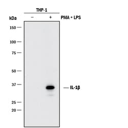 Human IL-1 beta/IL-1F2 Antibody, R D Systems 25&mu;g; Unlabeled:Antibodies,